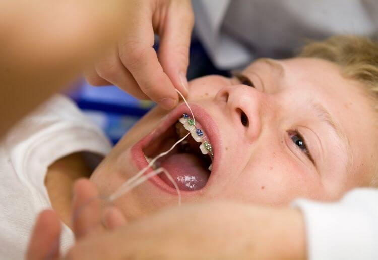 What is a floss threader?